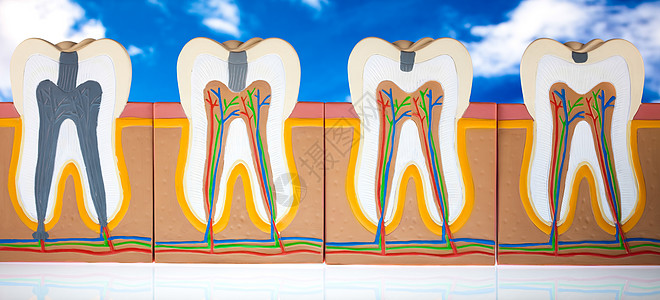 牙齿 亮亮多彩的音调概念咀嚼磨牙空腔打扫牙龈动脉指甲树脂假肢感染图片