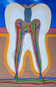 牙齿 亮亮多彩的音调概念牙科疼痛指甲牙医空腔牙龈身体牌匾衰变树脂图片
