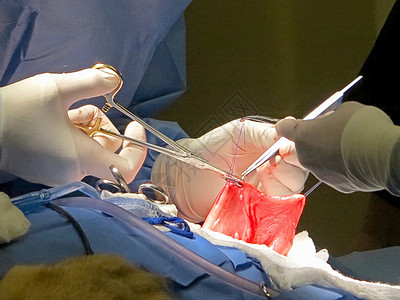 胃部抽取组织程序保健伤口母狮药品管子缝合器官手术图片