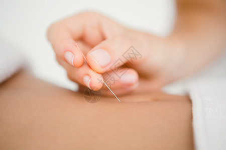 妇女用针刺治疗针针扎针头女性女士皮肤中心说谎休息身体按摩药品奢华图片