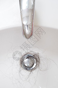 汇中毛发损失问题斑秃治疗白色癌症脱发女士卫生女性秃头保健图片