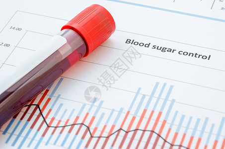 用于检测糖尿病测试的样本血液实验室同源性老年控制医生柳叶疾病医院监视葡萄糖图片