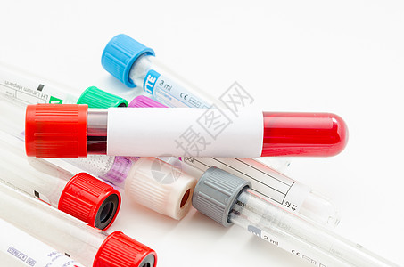 用于采集和血液样本的真空管透明度疾病贫血处方红细胞小球代码速度尿酸手套图片
