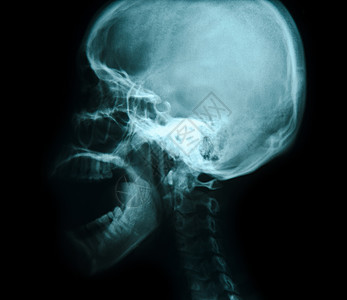 头骨X光照片脊椎骨椎骨脊柱x射线考试保健眼睛检查医院脊椎图片