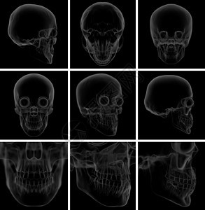 3d 使头骨在背景上辐射射线颅骨牙科药品考试电影测试治疗身体图片