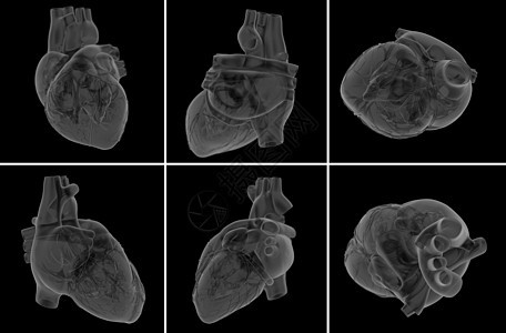 心脏的医学插图科学男性心血管腮腺炎卫生药品脉冲外科手术系统图片