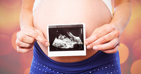 显示超声波扫描的孕妇综合图象睡衣超声腹部女士数字化服装身体照片怀孕女性图片