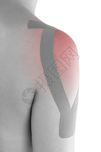 女性肩膀上的Kinesio磁带理疗治疗白色肌肉康复病人运动机肌内效疼痛粉色图片