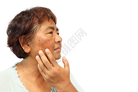 面部有破伤风 疮 摩尔和皱纹的老农村妇女(孤立的背景和右侧空白面积)(反年龄概念)图片
