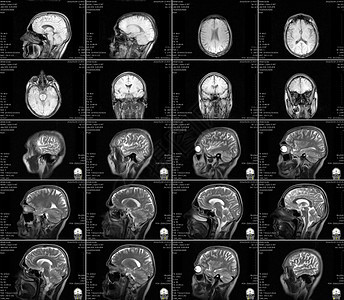 大脑的磁共振成像 没有明显的反常现象 笑声实验室解剖学电影核磁共振医院测试x光射线诊断谐振图片