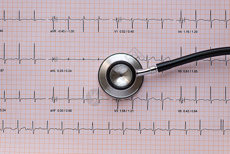 覆盖ECG或EKG的望远镜图片