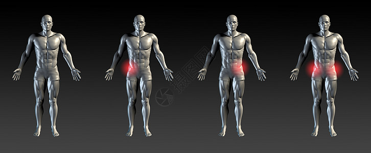 下流伤害扭伤疾病骨科卫生x射线男性收藏扫描红色医疗图片