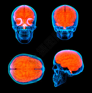 3d 使人类红脑X光图片