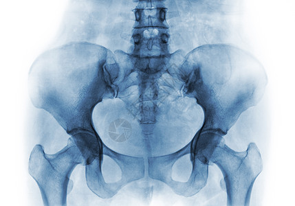 正常人类骨盆和臀关节X光片考试x光蓝色诊断尾骨脊柱x射线扫描药品股骨图片