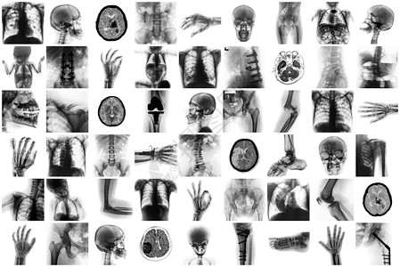 ct人体素材XX光人体和许多医疗状况和疾病的许多部分颅骨脊柱收藏骨骼保健男人扫描药品病人骨科背景