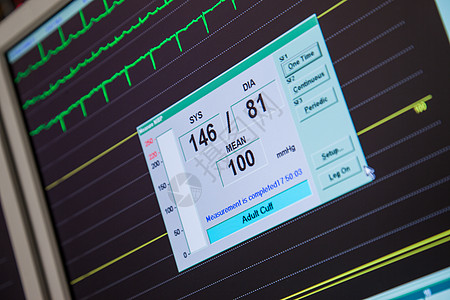 血压心脏病速率监测器图片
