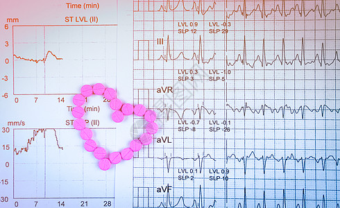 EKG 或 ECG 心电图 图形报告纸 EST 运动压力测试 结果和由药丸制成的粉红色心形 老年人或老年人概念中的心脏检查套餐推图片