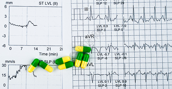 EKG或ECG(心电图)图表报告纸 EST(锻炼压力测试)结果和绿黄胶片丸;在老年人概念中促进心脏检查的一揽子措施图片