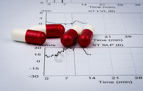 EKG或ECG心电图图表报告纸 EST锻炼压力测试结果和红白胶囊药片 在老年人概念中推广心脏检查包文档海浪冲动研究卫生考试胶囊电图片