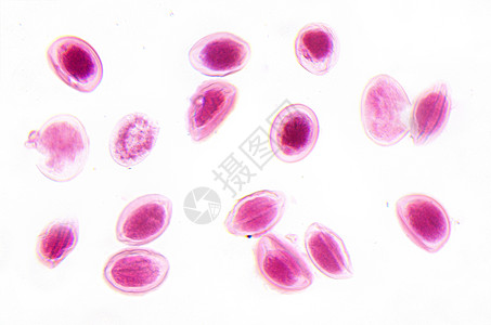 显微镜摄影 阿斯卡里斯蛋图片