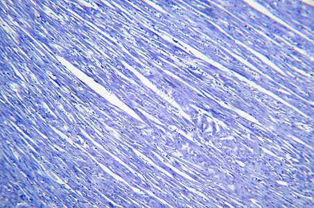显微镜摄影 心脏肌肉部图片