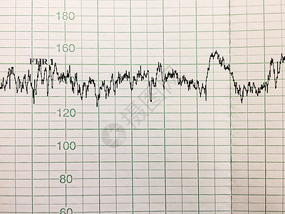 心血管报告的印刷母性金融医疗监视器保健数据女孩劳动频率诊断图片