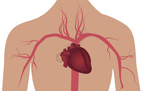 人体动脉系统船只梗塞治疗管子瘟疫静脉主动脉动脉硬化心脏病学凝块图片