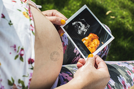 怀孕妇女持有子宫照片腹部生活孩子白色父母母亲扫描母性身体婴儿图片