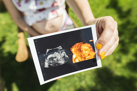 怀孕妇女持有子宫照片白色婴儿身体腹部母性女性母亲孩子扫描父母图片