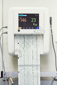近距离接近胎儿监测器的婴儿心跳图表诊断心脏病学机器医院分娩传感器药品房间新生图片
