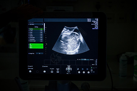 4D图像医疗超声波检查机 LABOR和医院产房图片