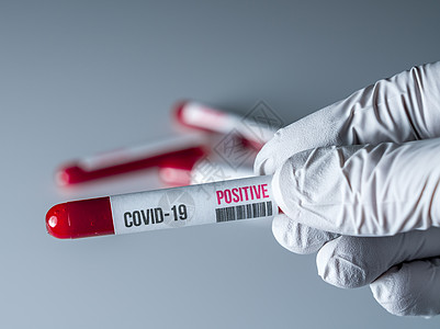 手套手握着血液测试管 对Corona病毒进行检测结果呈阳性医疗医生实验室药品疾病临床感染样本标签测试图片