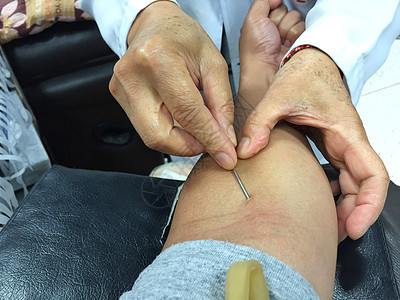 近身的亚裔男性被注射在手臂上的照片疾病志愿者捐赠者诊所输血技术员医院女士护士科学图片