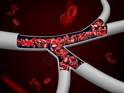 3d 红血细胞静脉说明 包括剪切路径插图形成动脉血小板血栓心血管静脉器官干涉细胞图片