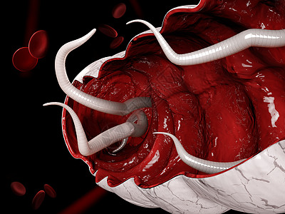 3d 大型肠道内有钩虫说明图片