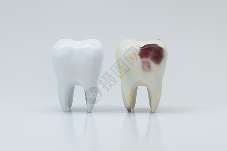 蛀牙旁边有白牙 3d 渲染卡通片口腔科牙科痛苦治疗衰变牙齿疼痛牙医卫生图片
