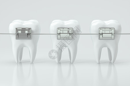 牙科牙套和牙齿 3D缝合凹痕制品卫生陶瓷生物学乐器牙医治疗渲染反射图片