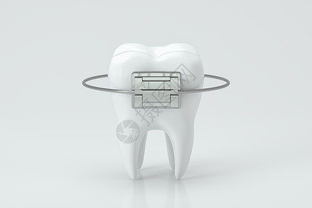牙科牙套和牙齿 3D缝合渲染凹痕白色反射卫生卡通片磨牙口腔科搪瓷治疗图片