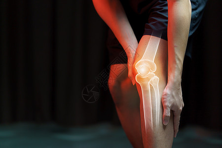 医疗概念 膝膝痛的人  骨架xr痛苦解剖学疾病医生症状女性女士肌肉药品腿痛图片