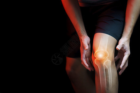 医疗概念 膝膝痛的人  骨架xr女士按摩压力腿痛疾病药品伤害身体痛苦膝盖图片