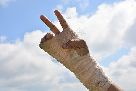 手腕疼痛的人 在巨型板条中 用天空背景的手指锻炼扭伤绷带夹板治愈伤害手臂病人援助从业者疾病图片