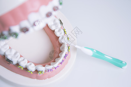 带有金属矫形剂的模型假牙治疗健康矫正支撑卫生牙医示范实验室牙科白色图片
