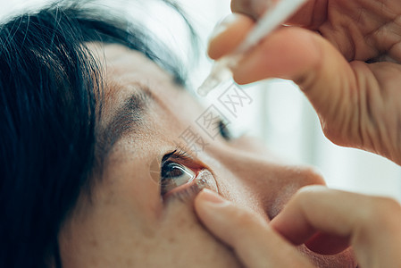 妇女使用眼滴 人工眼泪女性液体润滑剂眼球刺激泪液医师眼睛药品药店图片