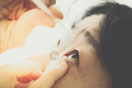 妇女使用眼滴 人工眼泪眼球女性女士滴管商品刺激治疗医院泪液润滑剂图片