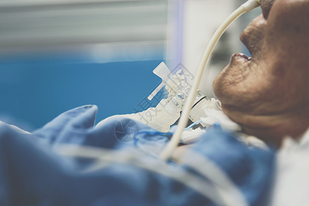 病人在医院做气管切除术和呼吸器医生老年保健单元科学管子房间疾病女孩乐器图片
