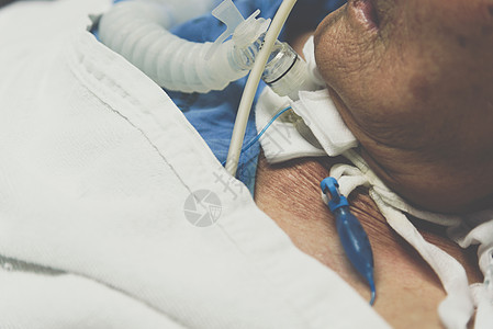 病人在医院做气管切除术和呼吸器呼吸机通风房间护理女性乐器药品身体病房疾病图片