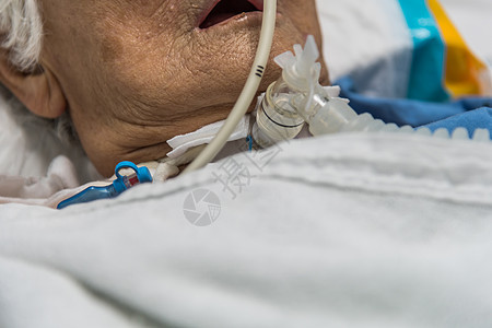 病人在医院做气管切除术和呼吸器手术从业者老年药品气管外科成人保健护理疾病图片