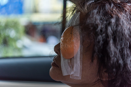 病人的亚洲女性用眼罩露出眼睛视网膜医生医院眼垫塑料康复疾病白内障成人女士图片