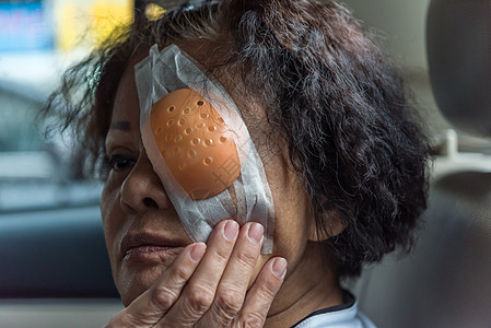 病人的亚洲女性用眼罩露出眼睛石膏角膜诊所成人视网膜老年治疗疼痛医生眼垫图片