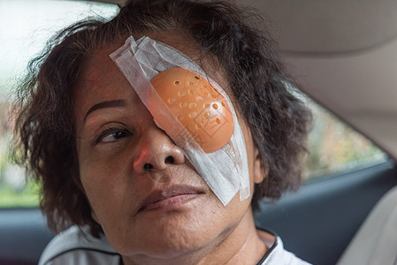 病人的亚洲女性用眼罩露出眼睛治疗康复眼科疼痛激光眼垫石膏医院卫生绷带图片